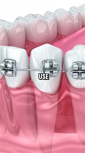 Why Straight Teeth Matter More Than You Think 😬