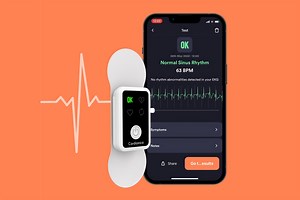 Cardionica: portable single-channel medical-grade ECG