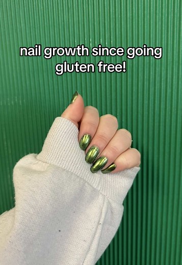 Celiac Disease: Transforming My Hair and Nails
