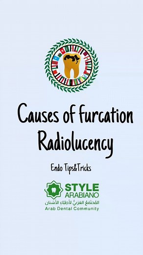 Causes of furcation Radiolucency Endo Tips&Tricks Credit dr @abdo_elkholi #stylearabianoteam #stylearabiano #Endo #furcation | Style Arabiano
