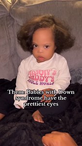 241K views · 23K reactions | People often say that babies with Down...
