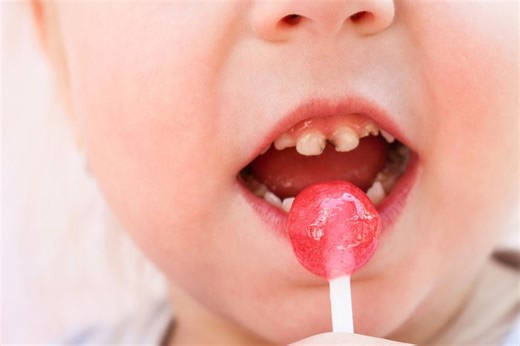 A quarter of parents admit they ‘forget’ to brush their kids' teeth  - Netmums