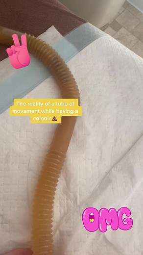 colonic_lady on TikTok