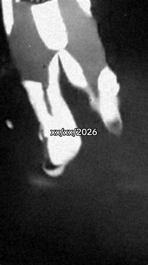 sorteio será? bio bio bio