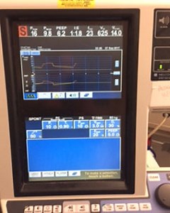 How to wean off ventilation and tracheostomy step by step! - Intensive Care Hotline