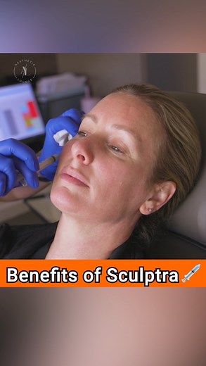 Sculptra Benefits 💉✨ #sculptra #sculptrafacial | Kevin Sadati