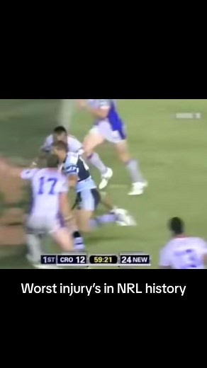 Worst Injuries in NRL History - Shocking Rugby League Accidents