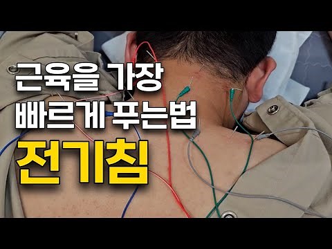 뭉친 근육을 풀어주는 가장 빠른 방법, 한의원 침 전기침 치료 효과 원리