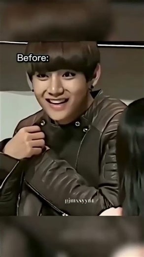 Kim Taehyung 💜 before & after #bts#btsarmygirl#viralshorts#💕🫰💜💜💜