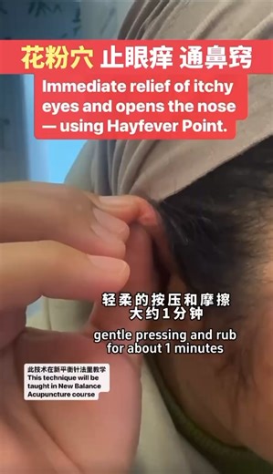 Hay Fever for Over 10 Years? Two Specific Points ： One Treatment, Real Relief. At Centre of Balance, we have been helping hay fever sufferers for over a decade using just two specific acupuncture points. Whether it’s: • ✔ Eyes so itchy you can’t keep them open • ✔ A completely blocked nose • ✔ Constant sneezing, head pressure, tight breathing Most patients walk in with severe symptoms. So far, every hay fever case treated with this method has improved in a single session,no follow-up required. M