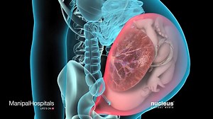 125K views · 1.7K reactions | The video describes a procedure known...