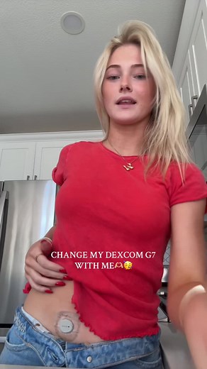 Dexcom Change Tips for Diabetes Management