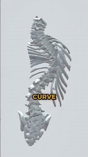 How to Reduce Scoliosis Curve (The SpineX Method)