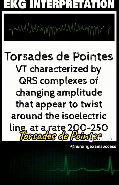 Torsades de Pointes: Understanding EKG Changes