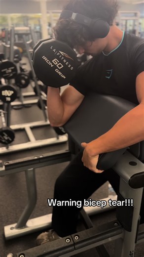 Bicep Tear Warning: Gym Safety Tips to Prevent Injury
