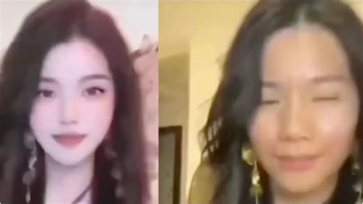 ലൈവിൽ ഫിൽറ്റർ ചതിച്ചു; യഥാർഥ മുഖം കണ്ട് ഞെട്ടി ഫാൻസ്; നഷ്ടമായത് 140,000 ഫോളോവേഴ്സിനെ