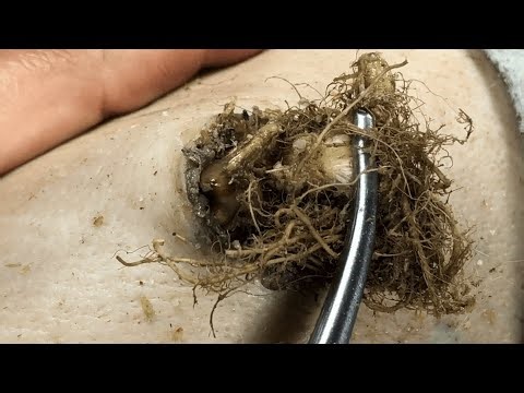 𝑻𝒉𝒆 𝑩𝒆𝒔𝒕 𝑹𝒆𝒎𝒐𝒗𝒊𝒏𝒈 𝑫𝒊𝒓𝒕 𝑼𝒏𝒅𝒆𝒓 𝑻𝒉𝒆 𝑺𝒌𝒊𝒏 𝑰𝒔 𝑹𝒆𝒇𝒓𝒆𝒔𝒉𝒊𝒏𝒈 𝑺𝒂𝒕𝒊𝒔𝒇𝒚𝒊𝒏𝒈 𝑨𝒏𝒅 𝑹𝒆𝒍𝒂𝒙𝒊𝒏𝒈 #90083763