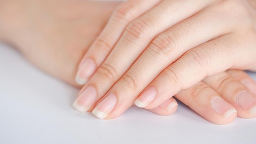 DAS haben Längsrillen in den Fingernägeln zu bedeuten und so wirst du sie wieder los
