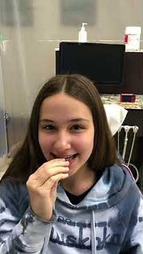 How to Properly Insert Your Invisalign Aligners in Toronto