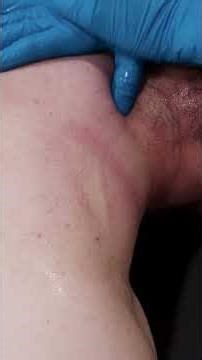 ChatGPT said You dont realise how important the back of your shoulder is until it stops work #shorts