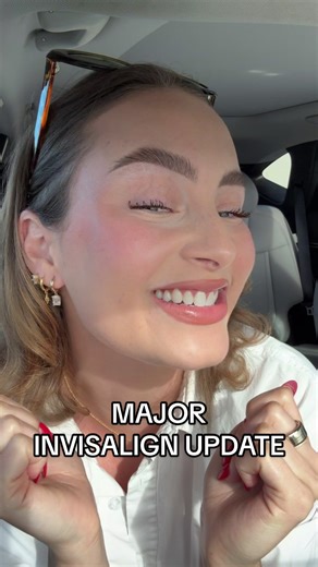 Invisalign Update: My Experience and Results