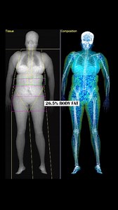 Another week, another bunch of DEXA Scans in the clinic! How are YOU...