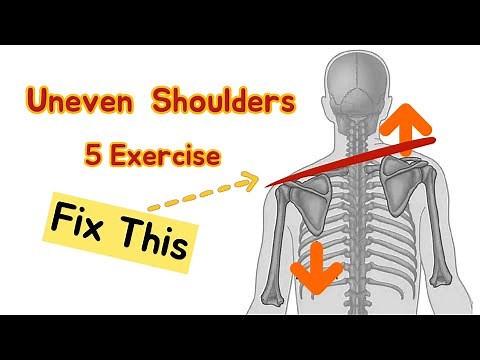 Uneven Shoulders How to Fix ? Exercises to correct Shoulder Level. Shoulder Asymmetry