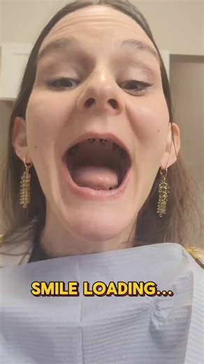 The incredible transformation of a woman without teeth after getting implant teeth: