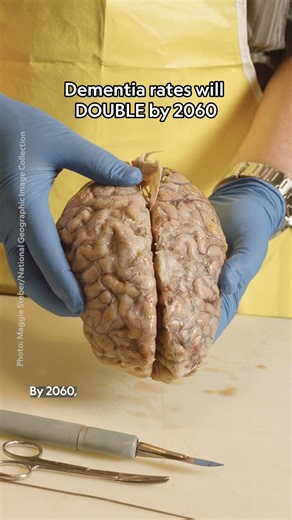 29K views · 385 reactions | By 2060, the number of Americans with dementia is expected to double. The statistic sounds alarming, but it represents some good news, too: people are living long enough to get diseases for which age is a factor, like dementia. Physician Keren Landman breaks down the alarming data, and shares what to do about it: https://on.natgeo.com/SCFB11162025 | National Geographic Science | Facebook