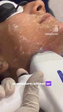 Breakout vs purging #dermatologist #skincare #explore