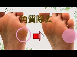 【足裏の角質除去】角質ができる原因を解説