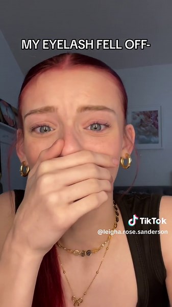 Eyelashes Falling Off: A Birthday Nightmare