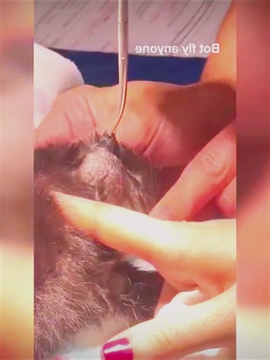 Remove botfly #remove #botfly #asmr #fyp #trending