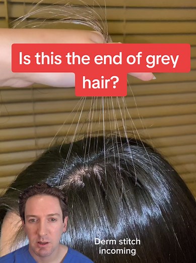 Exosome Therapy for Gray Hair: Early Study Shows Hair Repigmentation