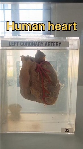 Real human heart specimen