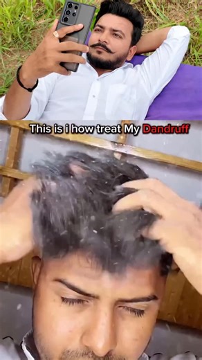 Suresh Chaudhary | 📣 Chachaji Reviewer 🔍 on Instagram: "3 Wash में Dandruff ख़त्म 😲 लेकिन ये गलती मत करना ❌ Honest review #74 Comment "Best" for product link 🔗 -- Dadi’s Nuskha vs. Modern Science ?? Why not BOTH ?? 🌿🧪 My scalp was acting like a snow machine this winter. ❄️ Instead of messy DIYs, I tested this powerhouse shampoo. Why it works: ✅ Neem: The natural healer. ✅ Ketoconazole: The doctor’s choice. The Timeline: 1️⃣ Wash One: "Okay, I see a difference." 3️⃣ Wash Three: "Wait, where