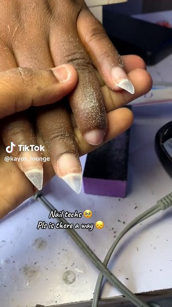 Understanding Clubbed Nails for Nail Technicians