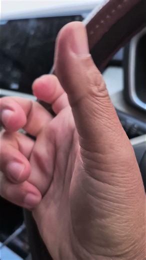 "Satisfying Knuckle Cracking ASMR 🦴✨