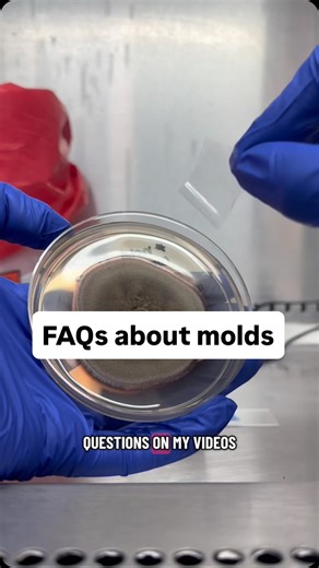 CellularBabe - Microbiology MLS on Instagram: "FAQs about molds!! Did I answer all your questions about molds? 🦠🧫🔬 #mlt #mls #medicallab #medicallaboratoryscience #medicallaboratory #lab #medicalstudent #nursingstudent #medtech #medtech #medicine #micro #microbiologist #microbiology #culture #mold #fungal #fungus"