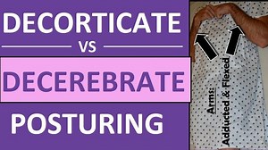 Decerebrate vs Decorticate Posturing Rigidity Mnemonic & Pictures Nursing Nclex