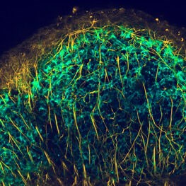Database of Immune Cell Epigenomics