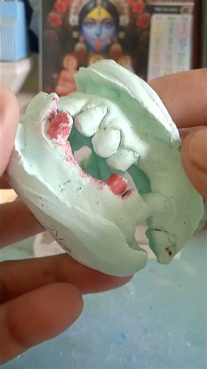 4 unit upper bridge #dentist #dentalartistry #dentalprosthesis #doctor