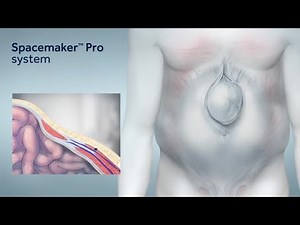 Spacemaker Proᵀᴹ MICST animation