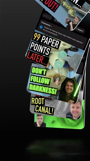 Dental Mystery Super Calcified Tooth or Weird Root