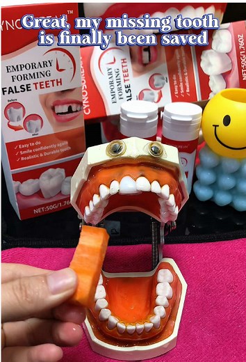 My missing teeth have finally been saved. It turns out that filling teeth is just that simple #teethfilling#missingteeth #brokentooth#denture #teethreplacement