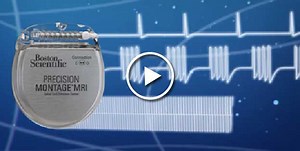 Boston Scientific Receives U.S. FDA Approval for Precision Montage™ MRI Spinal Cord Stimulator System