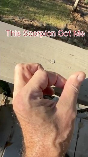 This Scorpion 🦂 Stung Me! During A DIY Project #diy