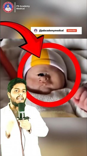 This Birth Defect Stops Most Babies #heartbreaking #medical