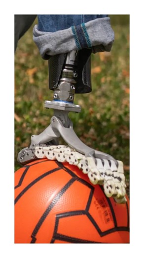 Mechabytes | This Prosthetic Moves Like Real Foot 🎥: @istitutoitalianoditecnologia . . . . . . . . . . . [bionic foot, prosthetic technology, human... | Instagram