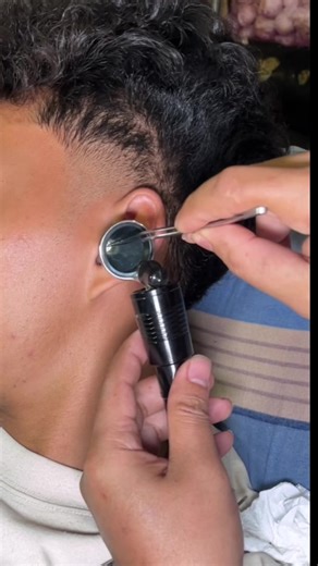 Effective Ear Cleaning Techniques for Better Hygiene
